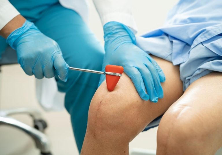Um profissional de saúde com luvas azuis examina o joelho de um paciente com um martelo de reflexo. Curso: Anatomia Cirúrgica e Exploração do Joelho.